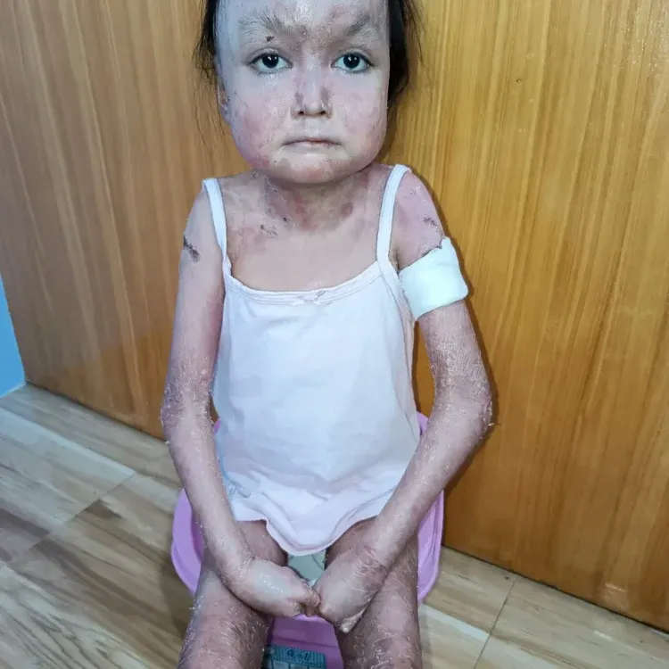 Please Donate to Stop Shamila's Severe Pain and Help Save Her Life — photo 1