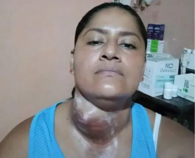 Help Patricia With Morphine and Treatment for Her Son — photo 1