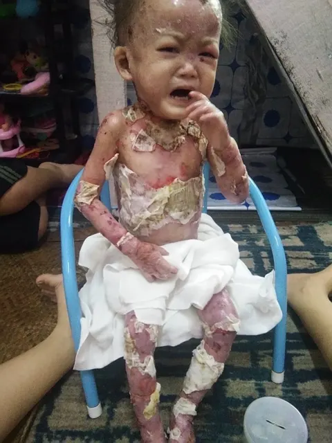 Please Donate to Stop Lily's Severe Pain and Help Save Her Life