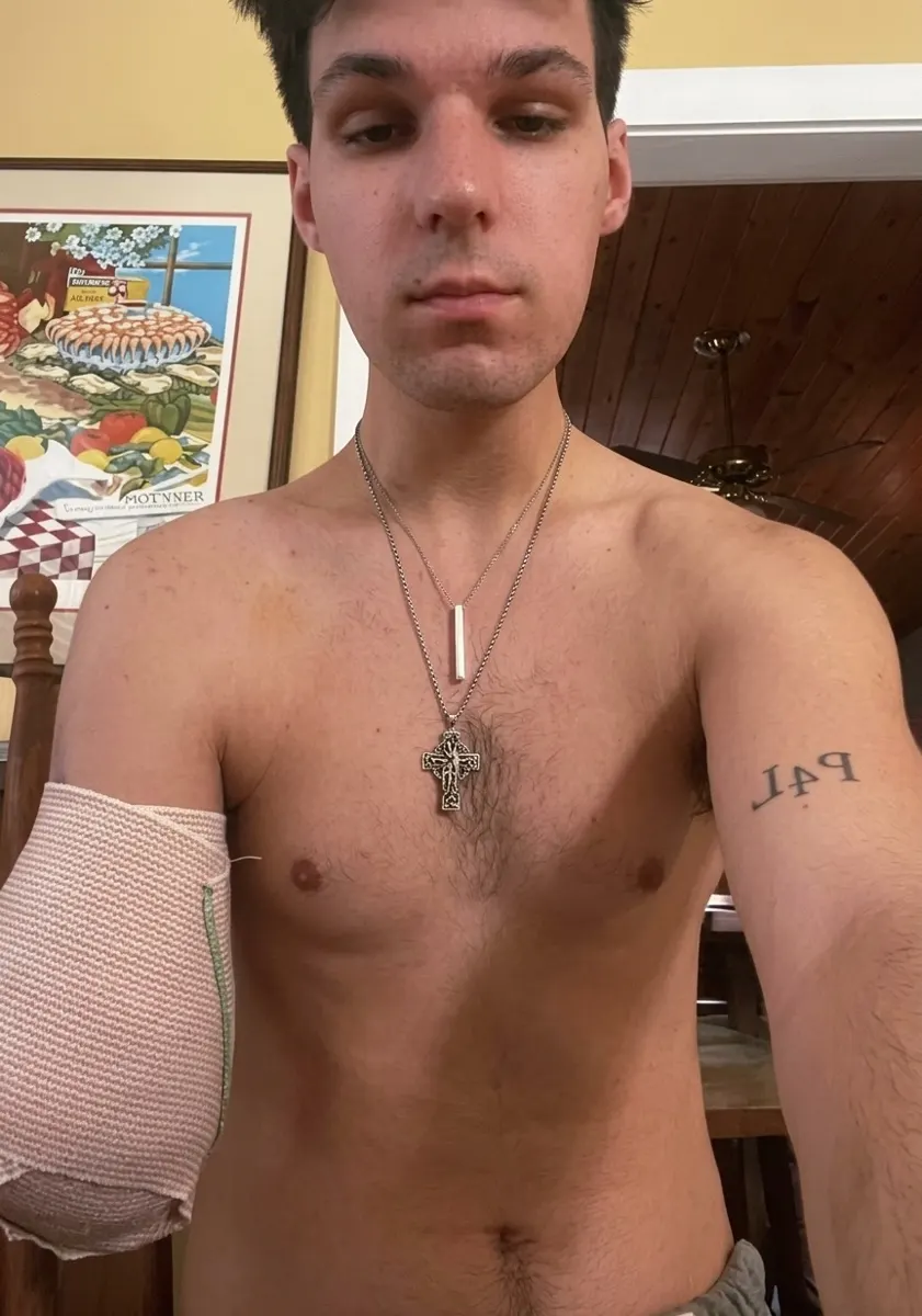 Help George Continue His Cancer Treatment and Get a Prosthetic Arm — photo 1