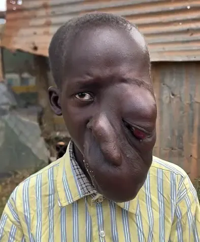 Akin Has 6 Months to Live — Be His Only Hope — photo 1