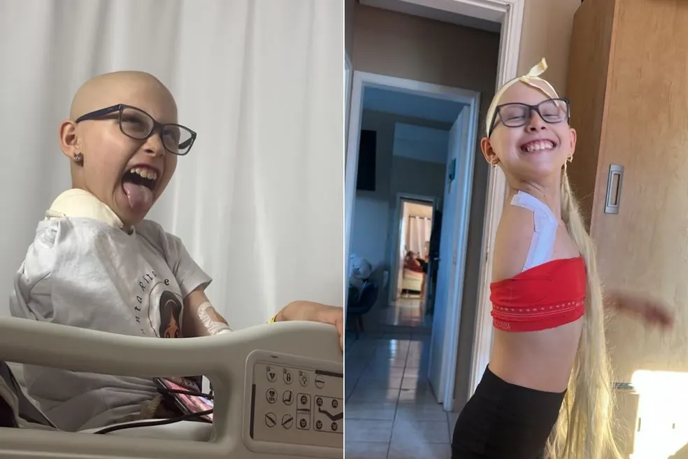 Hilary's journey before and after surgery shows the courage she carries into every stage of treatment. Photo: Family archive, as published by G1 Santos.
